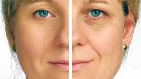 Sallow Skin: Causes, Remedies, and More Sallow Skin, Creme Anti Age, Anti Aging Creme, Anti Aging Wrinkles, Anti Aging Beauty, Anti Wrinkle Cream, Prevent Wrinkles, Les Rides, Wrinkle Cream