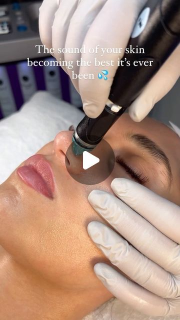 Hydrafacial on Instagram: "The most satisfying sound knowing your pores are being vacuum cleaned 🤩 #hydrafacial #asmrskincare" Pore Vacuum Videos, Facial Benefits, Skin Recipes, Hydra Facial, Most Satisfying, Skin Food, Clean Skin, Hair Skin, Knowing You