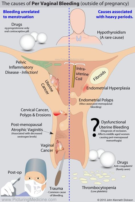 Organ Manusia, Obgyn Doctor, Endometrial Hyperplasia, Obstetrics Nursing, Obgyn Nurse, Medical Ultrasound, Nursing Student Tips, Surgical Nursing, Medical Surgical Nursing