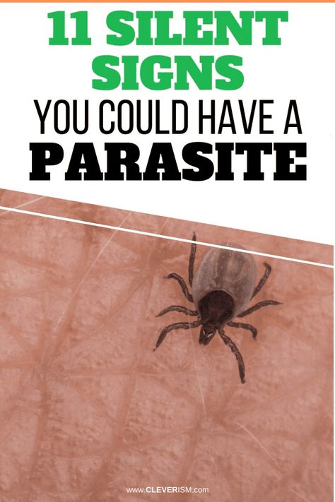 11 Silent Signs You Could Have a Parasite. Most people suffer unknowingly from parasites. Here's the definitive checklist. Find out whether you have parasites or not.  - #SilentSignsYouHaveAParasite #Parasites #Cleverism Career Quotes, Parasites Symptoms, Skin Parasites, Parasite Cleanse, Health Articles Wellness, Wellness Clinic, Job Interview Tips, Stomach Pain, Feeling Sick