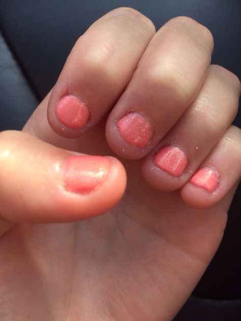 Short Bitten Nails, Bitten Nails, Finger Nails, Nail Biting, Nails For Kids, Short Nails, Toe Nails, Nail Designs