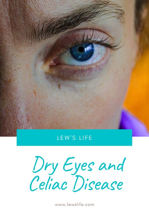 Did you know you could possibly get dry eye syndrome when you have celiac disease? Click the link to find out why. Gluten Free Facts, What Is Celiac, Celiac Symptoms, Celiac Diet, Celiac Awareness, Celiac Recipes, Going Gluten Free, Left Eye, Stomach Problems