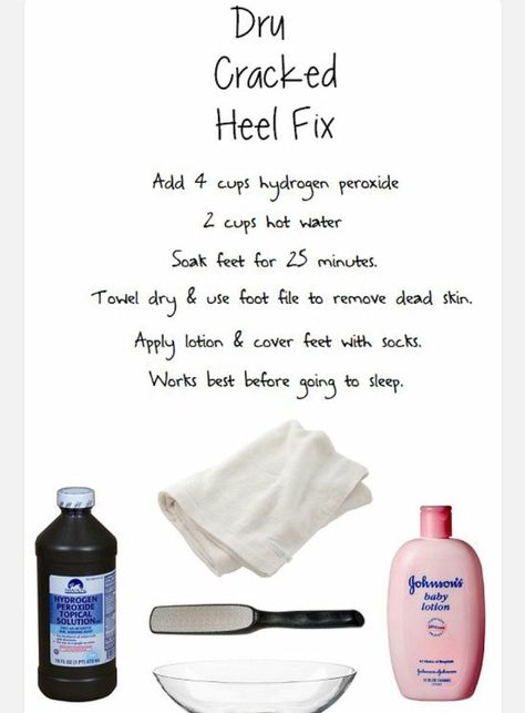 Dry cracked heels: causes, prevention, remedies and treatments Cracked Heels Diy, Diy Pedicure Soak, Cracked Heel Remedies, Pedicure Soak, Dry Cracked Heels, Dry Heels, Cracked Heel, Diy Pedicure, Cracked Heels