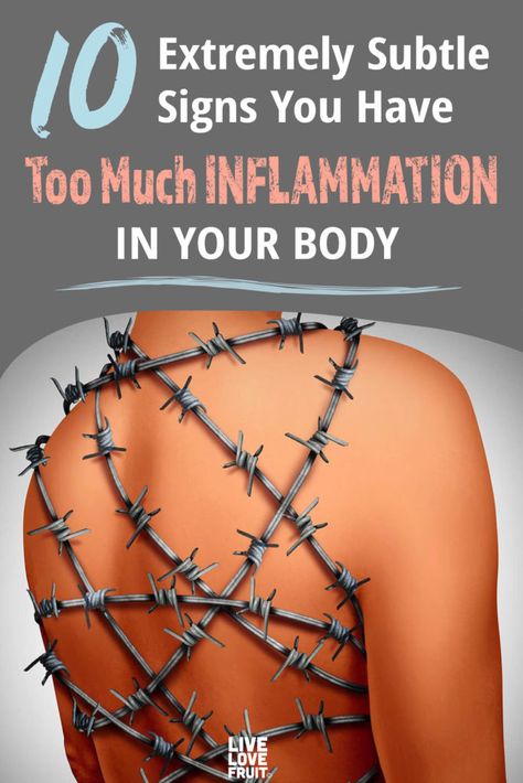 human body wrapped in barbed wire to demonstrate the pain of chronic inflammation with text - 10 extremely subtle signs your have too much inflammation in your body Eat Natural, Inflammation Remedies, Body Inflammation, Anti Inflamatory, Anti Inflammation Recipes, Inflammation Diet, Anti Inflammation, Thyroid Health, Chronic Inflammation