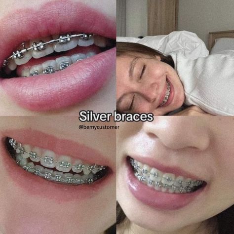 Braces With No Color, Grey Braces Color, Braces On Small Teeth, Silver Braces Color, Clear Braces Aesthetic, Braces Colors That Make Teeth Look White, Pink Braces Aesthetic, Baddie With Braces, Dark Purple Braces