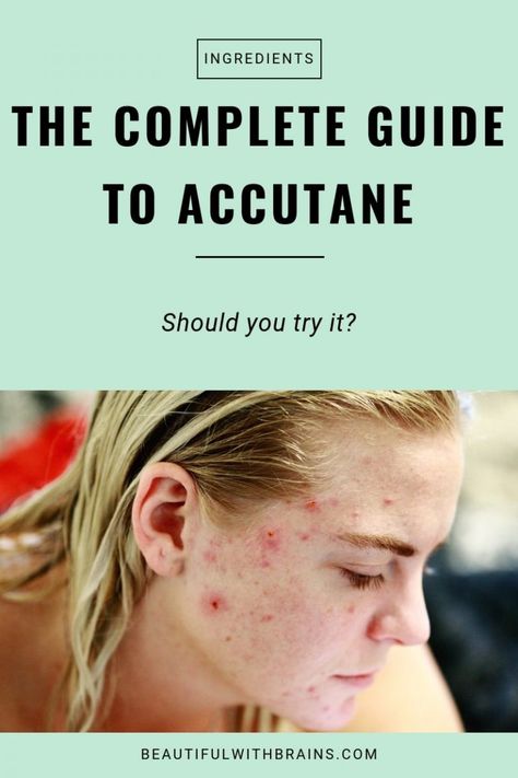 Natural Oils For Skin, Skincare Acne, Severe Acne, Benzoyl Peroxide, Cystic Acne, Acne Remedies, How To Get Rid Of Acne, Acne Skin, How To Treat Acne