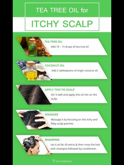 Best Tea Tree Oil, Shampoo Diy, Benefits Of Coconut, Flaky Scalp, Benefits Of Coconut Oil, Itchy Scalp, Hair Remedies, Dry Scalp, Natural Remedy