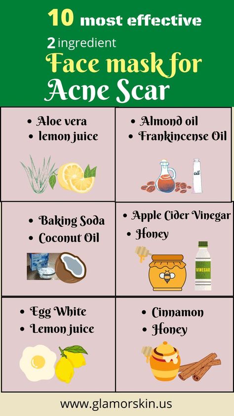 face mask for acne Pimple Scar Removal, Face Mask For Pimples, Face Masks For Acne, Masks For Acne, Face Mask For Acne, Acne Scar Mask, Mask For Acne, Blind Pimple, Pimples Under The Skin