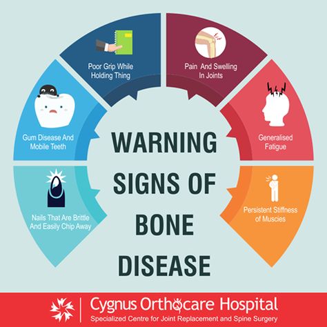 How To Break A Bone, Bone Diseases, Poor Nutrition, Fat Burning Diet, Spine Surgery, Bone Loss, How To Get Clients, Homeopathic Medicine, Nurse Life