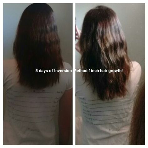 I gave the inversion method ago! Only tried it 5 days and am shocked it actually showed results! Give it ago x Inversion Hair Growth Method, Inversion Method For Hair Growth, Make My Hair Grow Faster, Hair Mask For Hair Fall, Mask For Hair Fall, Inversion Method, Hair Growth Methods, Hair Grow Faster, Prevent Ingrown Hairs