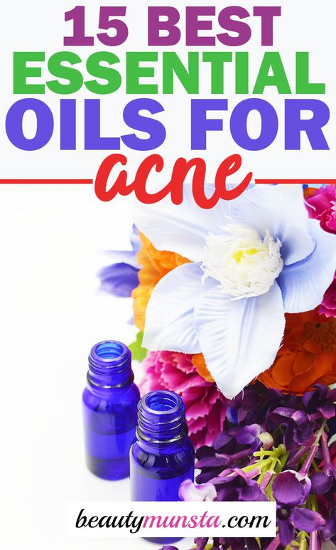 essential oils for acne Essential Oils For Acne, Oils For Acne, Natural Beauty Hacks, Essential Oils For Headaches, Acne Remedies, Best Essential Oils, Natural Beauty Tips, Acne Skin, Oils For Skin