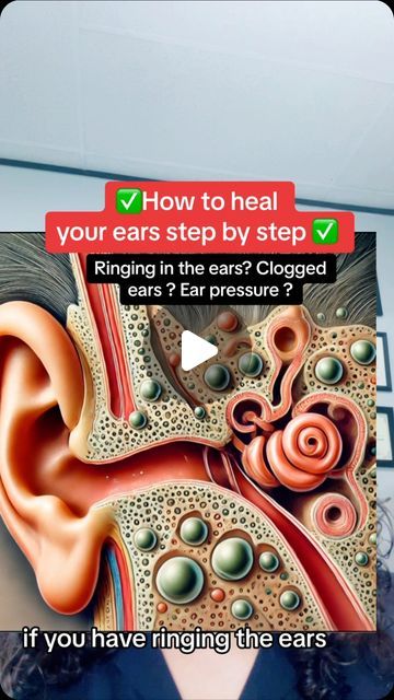 Raw (Mourab) Maraby on Instagram: "✅Ringing in the ears ears? Clogged ears pressure #hearingloss earpressure ear #ringingintheears #earwaxremoval" How To Get Rid Of Ringing In The Ears, How To Drain Ears Fluid, Pressure In Ears How To Relieve, Ear Health Tips, How To Unplug Your Ear, Ear Ringing Remedy, Clogged Ears From A Cold, Drain Ear Fluid, Ear Exercise