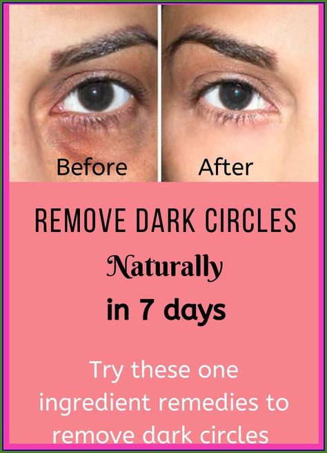 REMOVE DARK CIRCLES UNDER EYES IN 7 DAYS !!! Healthy Book, Dark Circles Under Eyes, Under Eyes, Remove Dark Circles, Cleanse Recipes, Creating A Newsletter, Years Younger, Dry Brushing, Health And Fitness Tips