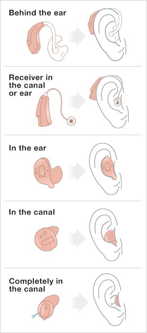 Hearing Aid Reference, Hearing Aid Drawing Reference, Ear Defenders Aesthetic, Hearing Aids Aesthetic, Deaf Tattoo, Fluency Assessment, Modern Oc, Hearing Aids Accessories, Outer Ear