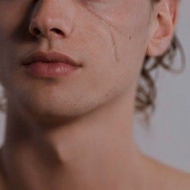 Lucien Vanserra, Frost And Starlight, Eye Scar, Lightning Scar, Facial Scars, Court Of Mist And Fury, Luke Castellan, Silver Flames, Acotar Series