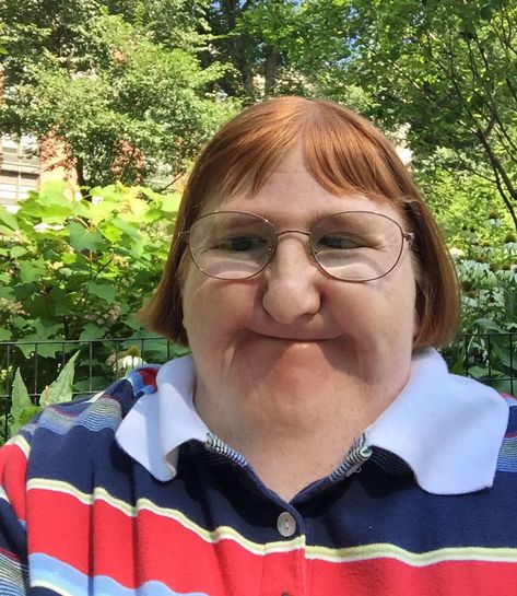 Trolls Tell Woman She’s ‘Too Ugly’ To Be Posting Pics Of Her Face, She Responds With 3 Selfies | Bored Panda Melissa Blake, Ugly Photos, Best Marriage Advice, Disabled People, Funny Profile, Funny Face, Good Marriage, New Teachers, Viral Post