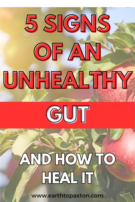 Foods to Heal Leaky Gut | Gut Health Diet | Leaky Gut Symptoms Natural Remedies |   Gut Healing Diet | Leaky Gut Remedies Foods To Help Heal Your Gut, Healing Gut Foods, How To Naturally Heal Your Gut, How To Heal Your Gut Microbiome, Gut Health Remedies, Healing Gut Inflammation, What Is A Leaky Gut, Super Gut Diet, Acv For Gut Health