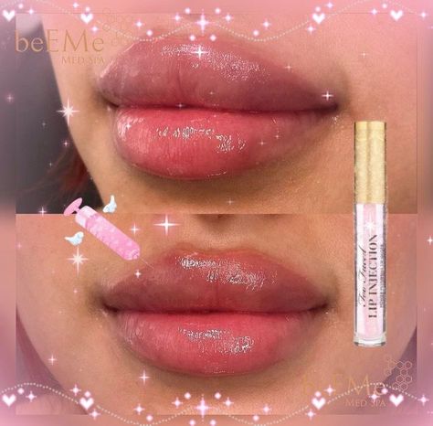 STRAWBERRIEKISSES♡ on Twitter: "https://t.co/wCsarZqLjd" / Twitter Brats Doll Lip Filler, Bratz Lip Filler, Bratz Doll Lip Filler, Doll Lips Filler, Round Lips Filler, Bratz Doll Lips, Bratz Lips, Bratz Doll Makeup, Fairy Eyes