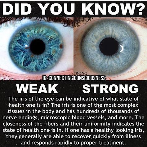 Thad Cheatham on Instagram: “This is a very good example of why every single one of us needs a good iridology reading! 👁 Just so we can see where we sit at genetically…” Connecting Consciousness, Iridology Chart, Ophthalmic Technician, Body Reading, Dr Morse, Mysterious Things, Healthy Thoughts, Alkaline Vegan, Eye Facts