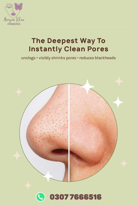 ORIGINAL APK NOSE STRIPS NOW AVAILABLE IN 599 PKR

SAY BYE TO DEAD PORES NOSE.

Nourish nose skinIt removes all dirt ,Pore ,Black heads from skin and makes nose skin shinier , clear .

#deal #sales #essence #makeup #cosmetics  #WhatsApp #XAUUSD #BackOurGirls #Iphone15 #PakvsSri How To Hide Pimples, Nose Peeling, Pimple Mask, Pimple Solution, Pimple Free Skin, Nose Pore Strips, Nose Pores, Blackheads On Nose, Pimples On Face