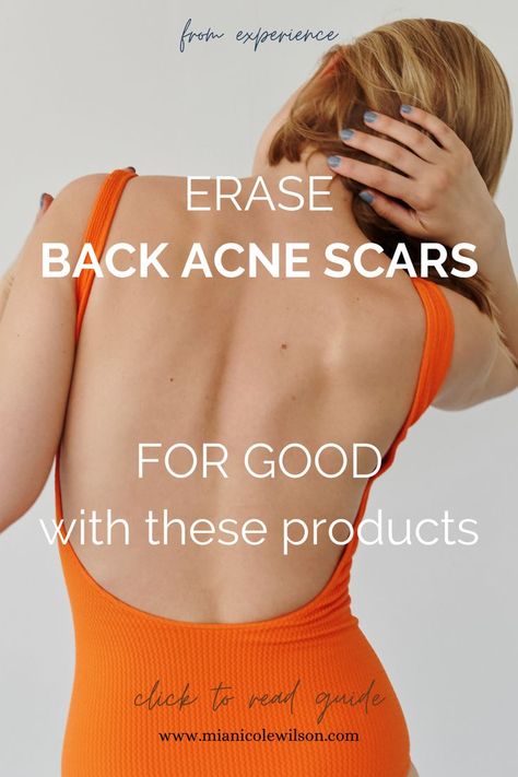 woman's back, guide showing how to get rid of back acne scars Get Rid Of Back Acne, Rid Of Back Acne, Best Acne Scar Removal, Acne Scar Remedies, Back Acne Remedies, Scar Remedies, Back Acne, Diy Acne, Acne Skincare Routine