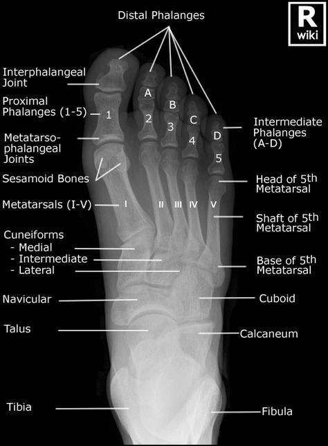 Radiographic Anatomy - Foot DP Radiology Schools, Radiologic Technology, School Scores, Radiology Student, Foot Anatomy, Radiology Imaging, Anatomy Bones, Radiology Tech, Radiology Technologist