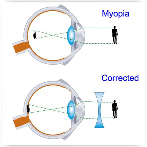 Eye Health Facts, Physical Science Lessons, Eye Vision, Physics Lessons, Learn Physics, Eye Care Center, Eye Anatomy, Basic Anatomy And Physiology, Biology Facts