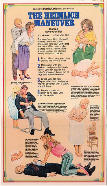 vintage heimlich maneuver poster http://www.pinterest.com/sthomas68/occupational-and-physical-therapy/ Heimlich Maneuver, First Aid Tips, Emergency First Aid, Emergency Medicine, Survival Life, Medical Knowledge, Emergency Prepping, Medical Education, Medical Information