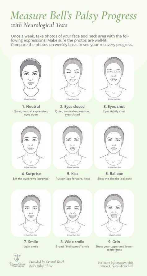 Facial Palsy Exercise, Bells Palsy Facial Exercises, Bell’s Palsy Exercises, Tens Unit Placement, Bell’s Palsy, Bf Ideas, Nerve Conduction Study, Combine Pictures, Bells Palsy