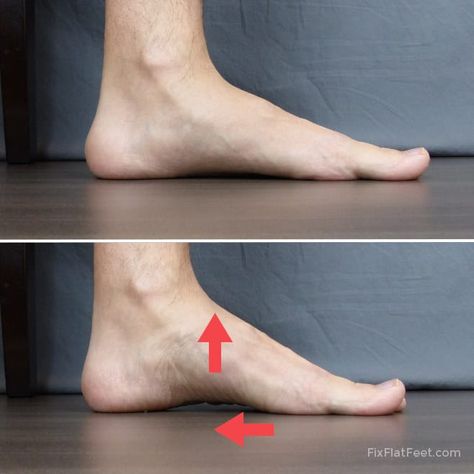 Flat Feet Exercises, Flat Feet Pain, Ankle Strengthening Exercises, Ankle Exercises, Lower Leg Muscles, Foot Stretches, Simple Routine, Fallen Arches, Foot Exercises