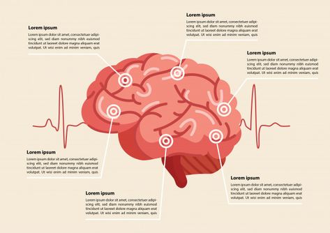 Human brain stroke illustration | Premium Vector #Freepik #vector #infographic #medical #cartoon #doctor Brain Vector Illustration, Anatomy Infographic, Medical Magazine, Brain Infographic, Medical Diagrams, Medical Cartoon, Medical Infographic, Health Infographic, Brain Illustration