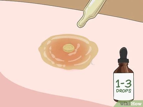 Boil Home Remedy How To Get Rid, Essential Oil For Boils On Skin, Herbs For Boils, Diy Boil Remedies, Skin Boil Remedies, Underarm Boils How To Get Rid, Abcess Remedy For Skin, Get Rid Of Boils Fast, How To Get Rid Of Boils