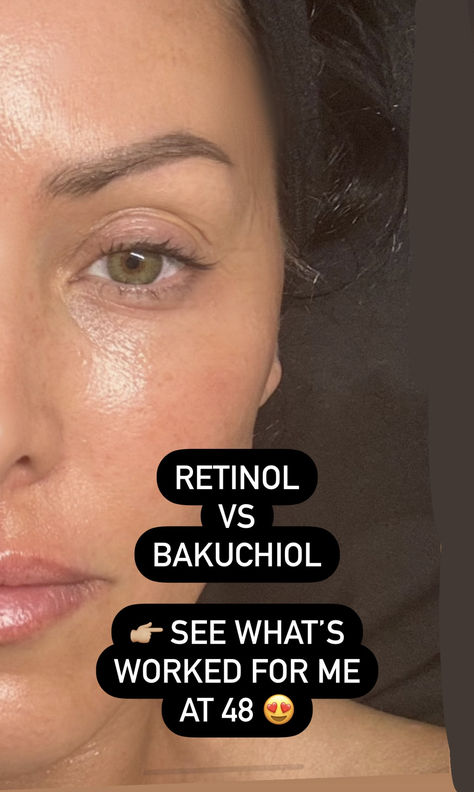 Natural Retinol Diy, Retinol Benefits, Oil Benefits, Best Oils, Skin Benefits, Birthday List, Clean Skincare, Skincare Ingredients, Health Advice