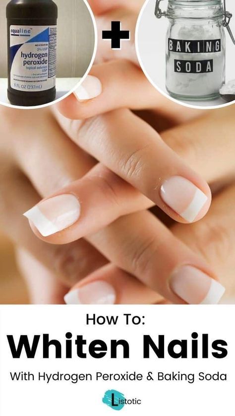 Learn how to whiten your nails with just hydrogen peroxide and baking soda! If you have stubborn stains on your nails that refuse to go away, then this simple life hack may be what you're looking for. Click on the pin for the full instructions and more nail whitening methods over on Listotic! #lifehack #manicure How To Whiten Nails, Baking Soda Nails, Make Nails White, Stained Nails, Nail Whitening, Nail Polish Stain, Baking Soda Uses, Baking Soda Shampoo, Nail Health