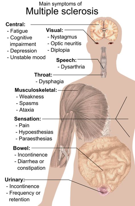 Multiple Sclerosis Symptoms, Ms Symptoms, Ms Awareness, Multiple Sclerosis Awareness, Med Student, Signs And Symptoms, Neurology, The Human Body, Autoimmune Disease