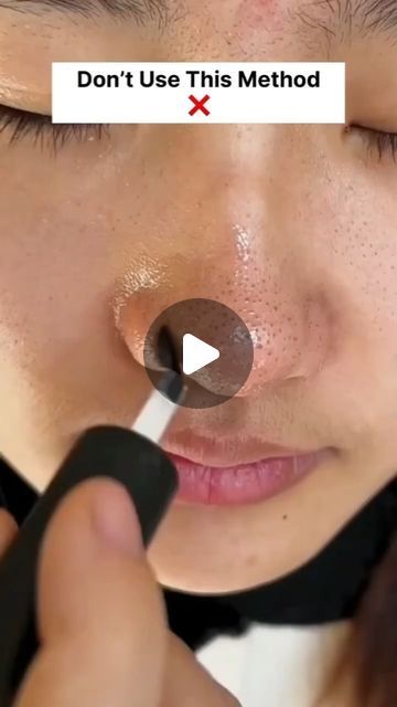 Black And White Heads Removal, How To Remove Blackheads From Face, How To Remove Black Heads, How To Get Rid Of Black Heads, How To Remove Blackheads From Nose, White Heads Removal Remedies, Black Heads Removal Homemade, Black Heads On Nose, White Head Removal