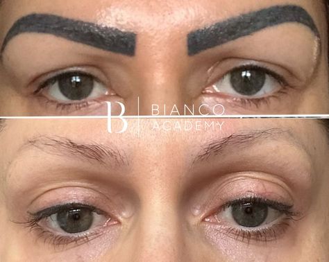 Remove Eyebrow Tattoo, Brow Tattoo Aftercare, Pmu Eyebrows, Eyebrow Tattoo Removal, Eyebrows Tattoo Permanent Makeup, Eyebrows Tattoo, Cosmetic Tattoo Eyebrows, Remove Tattoo, Tattoo Eyebrows