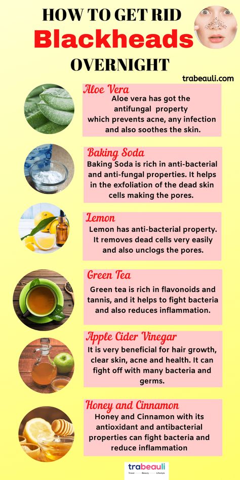 How To Remove Blackheads At Home Permanently – Best Beauty Lifestyle Blog How To Remove Blackheads, Blackhead Remedies, To Remove Blackheads, Cold Medicine, Rid Of Blackheads, Home Remedy For Cough, Cold Sores Remedies, Remove Blackheads, Natural Health Care