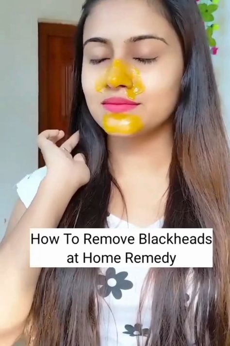 Blackheads Removing Home Remedy#Blackheads#home remedy Face Hair Removal, Blackhead Remedies, Blackheads On Nose, To Remove Blackheads, Clear Skin Face, Diy Skin Care Routine, Natural Face Skin Care, Slim Diet, Good Skin Tips