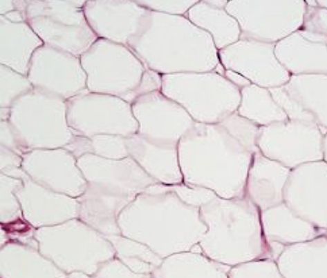 This tissue is made of white and clear cells that store fat droplets, so wherever there is fat there is adipose tissue! This tissue with fat insulates the body and provides cushion and energy. One can identify this tissue by its big white circles that represent the fat cells in the body. An issue with this can become if there becomes too much/big of adipose tissue created because that then would result in obesity. Loose Connective Tissue, Histology Slides, Microscope Parts, Cell Structure, Connective Tissue, Structure And Function, Human Anatomy And Physiology, Adipose Tissue, Body Tissues