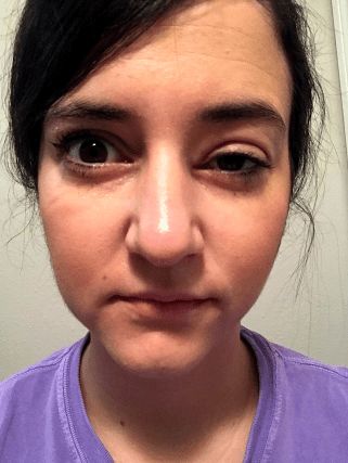 Sjogrens Syndrome Symptoms Signs, Sjögren’s Syndrome, Sjogrens Syndrome Symptoms, Sjogren Syndrome, Sjogrens Syndrome Diet, Scleroderma Symptoms, Eye Health Facts, Autoimmune Disease Symptoms, Ra Symptoms