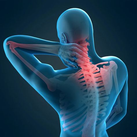 How to Relieve Stiff Neck Pain Using Trigger Point Massage at Home - Trigger Point Massage, Stiff Neck, Trigger Point, Self Massage, Trigger Points, Body Pain, Massage Techniques, Neck Pain, Back Pain