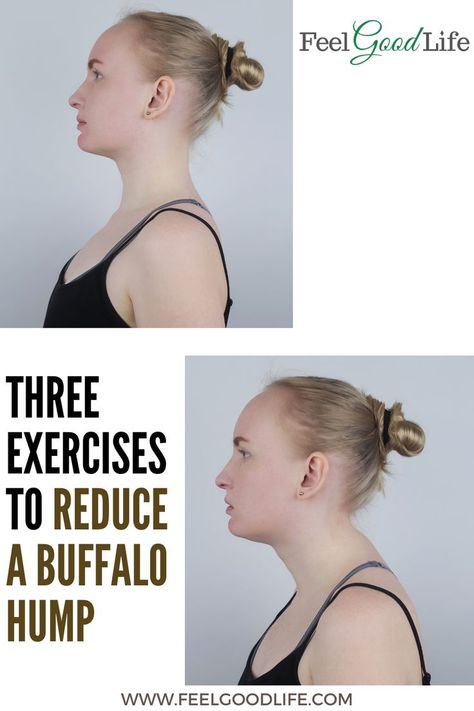 Improve Posture Exercises, Hunched Back, Neck And Shoulder Stretches, Shoulder Pain Exercises, Neck Hump, Chin Tuck, Body Inflammation, Lower Back Pain Exercises, Neck Exercises