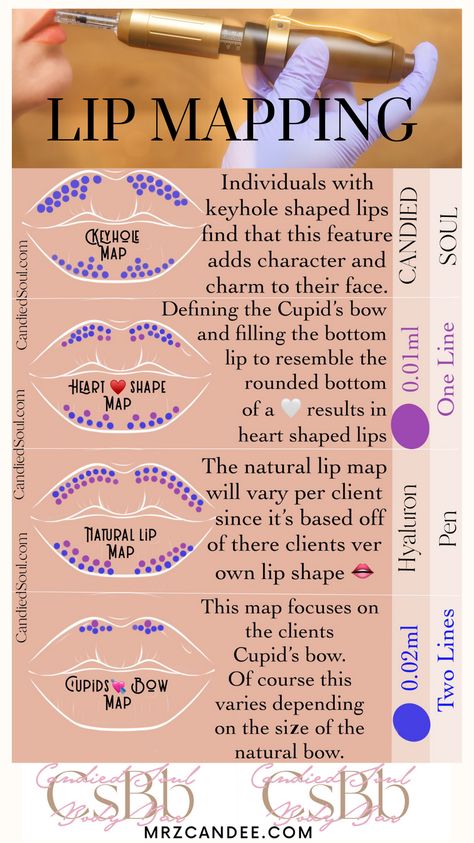 Lip augmentation, Lip fillers, noninvasive lip filler, hya pen, hyaluron acid, brows, microblading, powdered brows, permanent makeup, cosmetic tattooing, makeup artistry, PMU, PMUA Lip Filler Studio Decor, Lip Mapping Hyaluron Pen, Hyaluronic Pen Lips, Lip Filler Mapping, Hyaluron Pen Lip Mapping, Needless Lip Filler, Lip Mapping, Dermal Fillers Lips, Mircoblading Eyebrows