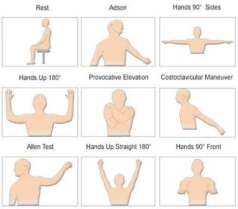 Thoracic Exercises, Carpel Tunnel Syndrome, Thoracic Outlet, Carpel Tunnel, Gait Cycle, Physical Therapy Student, Pta School, Neck Yoga, Tight Hip Flexors