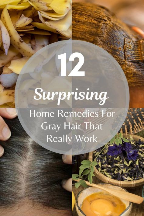 12 Surprising Home Remedies For Gray Hair That Really Work Grey Hair Natural Remedy, Dry Gray Hair, Cover Gray Hair Naturally, Grey Hair Home Remedies, Stop Grey Hair, Grey Hair Remedies, Prevent Grey Hair, Reverse Gray Hair, Home Remedies For Allergies