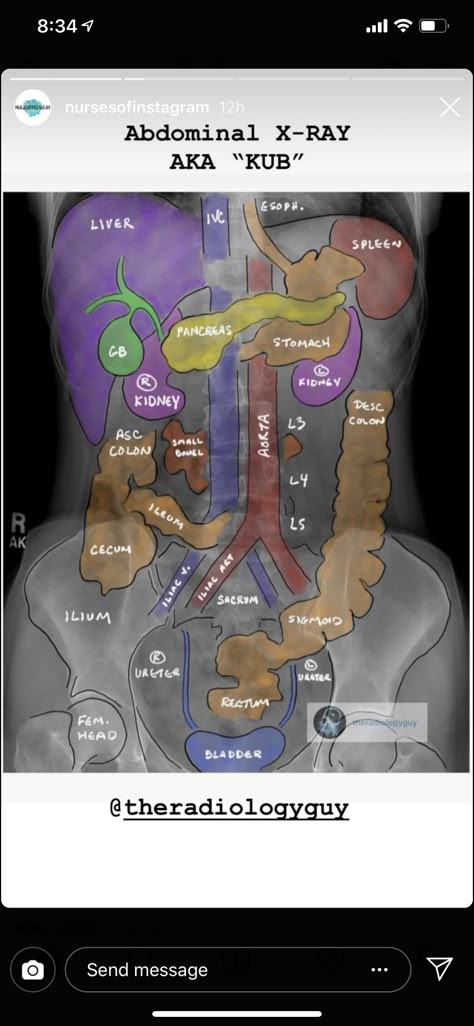 Radiology Student, Surgical Technologist, Nurse Study Notes, Nursing Student Tips, Nurse Midwife, Medical Student Study, Nursing School Survival, Nursing School Studying, Nursing School Tips