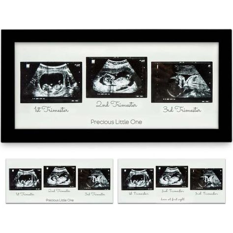 Mom To Be Gifts, Baby Ultrasound Pictures, Sonogram Picture Frame, Ultrasound Picture Frame, Ultrasound Frame, Baby Sonogram, Sonogram Pictures, Pregnant Mom Gifts, Simplicity Is Beauty