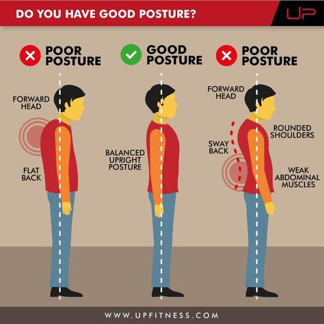 Fix Bad Posture, Posture Correction Exercises, Fix Your Posture, Strength Exercises, Posture Exercises, Muscle Imbalance, Bad Posture, Body Posture, Posture Corrector