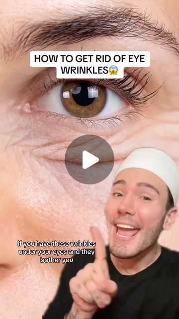 Remove Eye Wrinkles, Reduce Eye Wrinkles, Regular Skin Care Routine, Eye Wrinkles, Wrinkle Remedies, Skin Lightener, Facial Wrinkles, Proper Skin Care, Best Skin Care Routine